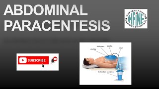 ABDOMINAL PARACENTESIS NURSING PROCEDURE [upl. by Enileuqkcaj]