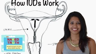 How an IUD Works  Episode 18 [upl. by Ived191]