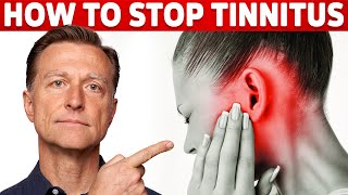 How to Stop Tinnitus ringing in the ears – Try DrBergs Home Remedy to Get Rid of It [upl. by Dorsey]