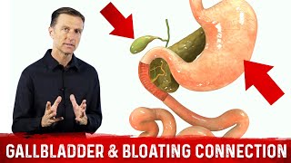 Gallbladder amp Bloating Connection Part 1 – DrBerg Bloated Stomach amp Gallbladder Function [upl. by Ellenij]