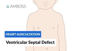 Ventricular Septal Defect VSD  Heart Auscultation  Episode 11 [upl. by Sila]