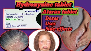 Hydroxyzine  How it works in pruritus and urticaria [upl. by Arrik569]