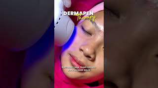 Parut lekuk Jom dapatkan rawatan Dermapen Therapy dengan RM130 saja SAH SEHINGGA 30 SEPT 2024 [upl. by Dib]