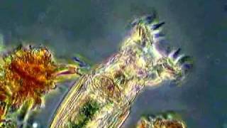 Rotifer Feeding II [upl. by Seaver]