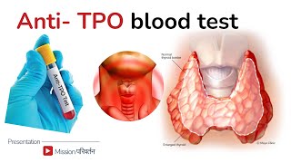 AntiTPO antibodies  treatment for high antiTPO [upl. by Fiske]