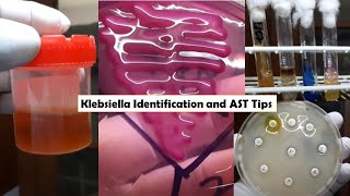 ESBL Producer XDR Strain Klebsiella pneumoniae isolation from Urine Culture and Sensitivity [upl. by Ev129]