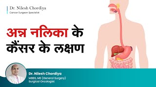 अन्न नलिका के कैंसर के लक्षण  Esophageal cancer symptoms  Food pipe cancer Hindi  Dr Nilesh [upl. by Nerrot]