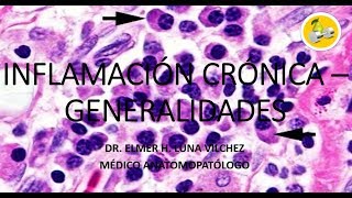 INFLAMACIÓN CRÓNICA – GENERALIDADES  Dr Elmer Luna Vilchez [upl. by Erhard886]