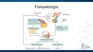 Fisiopatología Síndrome de Ovario Poliquístico [upl. by Adnawahs940]