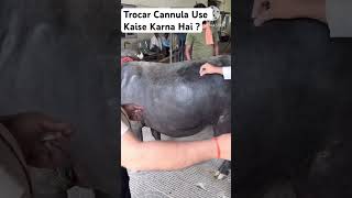 Trocar Cannula  Bloat  अफरा या पेट फूलने पर ट्रॉकर कैन्नुला कैसे डालें [upl. by Steddman]