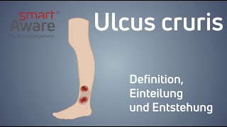 Ulcus cruris Definition Einleitung und Entstehung  Wundmanagement in der Pflege  smartAware [upl. by Adil]