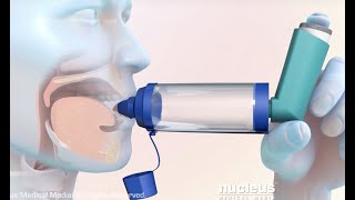 How to Use a Metered Dose Inhaler with a Spacer [upl. by Silin346]