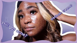 Tretinoin for Hormonal Acne 7 Month Update  My Skin Journey [upl. by Hamas]