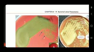 Apurba S Sastry Microbiology Bacterial Lobar Pneumonia Part 1 [upl. by Tearle]