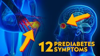 12 Warning Signs of Prediabetes What You Need to Know [upl. by Reitrac493]