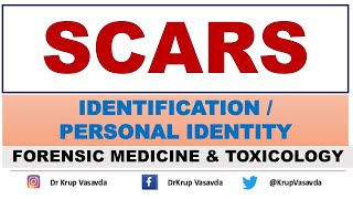 Scars  Identification  Dr Krup Vasavda [upl. by Adnicul739]