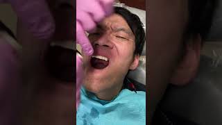 All on 8 Dental Implant Video 2 [upl. by Fanchette]