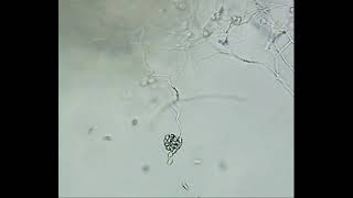 Release of Zoospores by Pythium sp [upl. by Herbie]