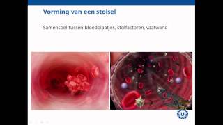 Hemostase deel 1 Inleiding  Prof dr REG Schutgens [upl. by Alodi]