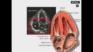 Echocardiography Introduction [upl. by Gwenni263]