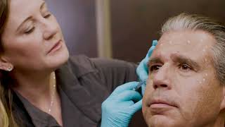 How Much Does Botox Cost  Senara Health and Healing Center amp Spa [upl. by Kosiur]