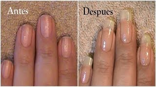 Cuanto Crecen Las Uñas en 3 Meses [upl. by Ellah]