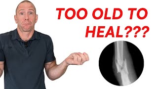 At what age can we reverse osteoporsis [upl. by Rothberg]