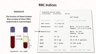 How to Interpret RBC Indices eg hemoglobin vs hematocrit MCV RDW [upl. by Loar346]