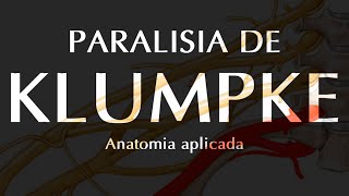 QUEDA COM LESÃO DE PLEXO  E agora  Paralisia de Klumpke  Anatomia Aplicada [upl. by Llekcir]