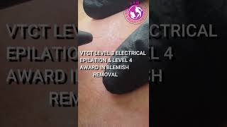 VTCT Level 4 Blemish RemovalElectrolysis Course Skin Blemish Level 4 Award in Skin Blemish Removal [upl. by Whang]