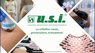 La Cellulite cause prevenzione trattamenti [upl. by Avruch]