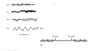 Electroencefalograma y ondas cerebrales [upl. by Eveiveneg]