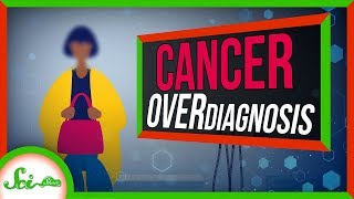 When You Have Cancer But Youre Fine Cancer Overdiagnosis [upl. by Lurline]