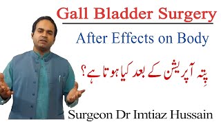 What Happens to Body after Gall Bladder Surgery  Surgeon Dr Imtiaz Hussain [upl. by Gusty]