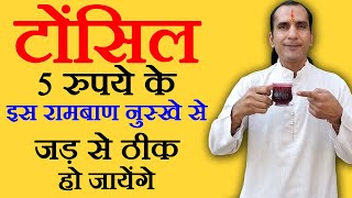 टॉन्सिल का घरेलू उपचार tonsil ka ilaj  How To Cure Tonsils  tonsil kaise thik kare [upl. by Bran]