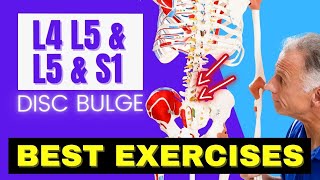 L4 L5 amp L5 S1 Disc Bulge Best Exercises Rehab For Relief [upl. by Reppart]