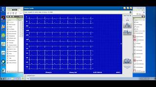 Connex Cardio ECG and Allscripts Professional DemoUSEnligsh [upl. by Hanover]