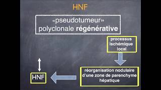 Tumeurs du foie  Bénignes  4 Hyperplasie Nodulaire Focale [upl. by Linker]