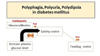 Polyuria Polyphagia Polydipsia in Diabetes mellitus [upl. by Oreves]