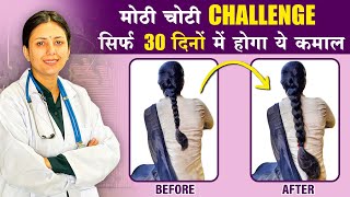 30 Days Challenge  इस उपाय से बालों को मिलेगी दोगुनी तेजी से उगने की शक्ति❤️  Upasana Ki Duniya [upl. by Animrelliug]