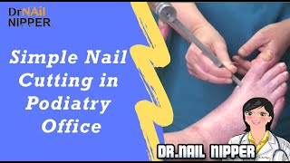 Simple Toenail Cutting in Podiatry Office Chemotherapy and Neuropathy [upl. by Pippy387]