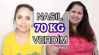 NASIL 70 KİLO VERDİM Part 2 Nasıl Zayıfladım Vücudum Sarktı Mı Nerede Ameliyat Oldum Buşra İpek [upl. by Gilliam]