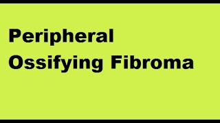 Peripheral Ossifying Fibroma [upl. by Windy]