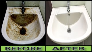 How To Turn Dirty Wash Basin Sink Into Pure White at Home Ceramic amp Porcelain Sink Cleaning [upl. by Zandra]