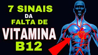 7 SINAIS que VITAMINA B12 está BAIXA Sintomas de Deficiência de Vitamina B12  Cobalamina [upl. by Eedissac613]