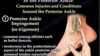 Ankle Pain Complete Overview  Everything You Need To Know  Dr Nabil Ebraheim [upl. by Ecidnacal793]