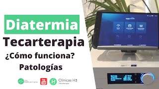 ¿Qué es la tecarterapia Patologías indicadas ✅ Diatermia Madrid Clínicas H3 [upl. by Jay25]