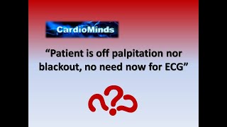 Cardiac Delusions ECG while off Palpitation or Syncope [upl. by Haduj112]