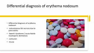 Medical Zone  Differential Diagnosis of Erythema Nodosum [upl. by Nedle910]