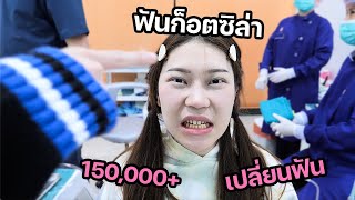 ฟันก็อตซิลล่า เปลี่ยนฟันใหม่หลักแสน 150000 ปากเหม็นเป็นขยะจริง [upl. by Lew413]